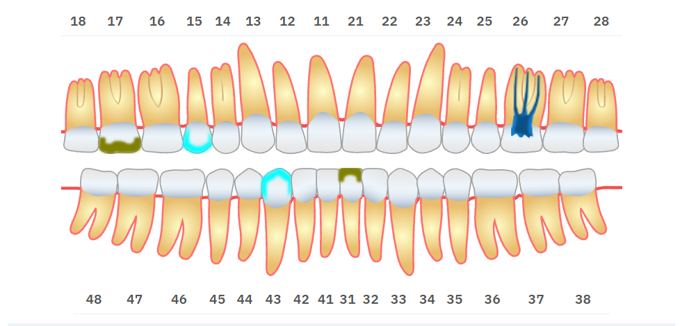 DentoNerve treatment chart with dental arches and planned treatments